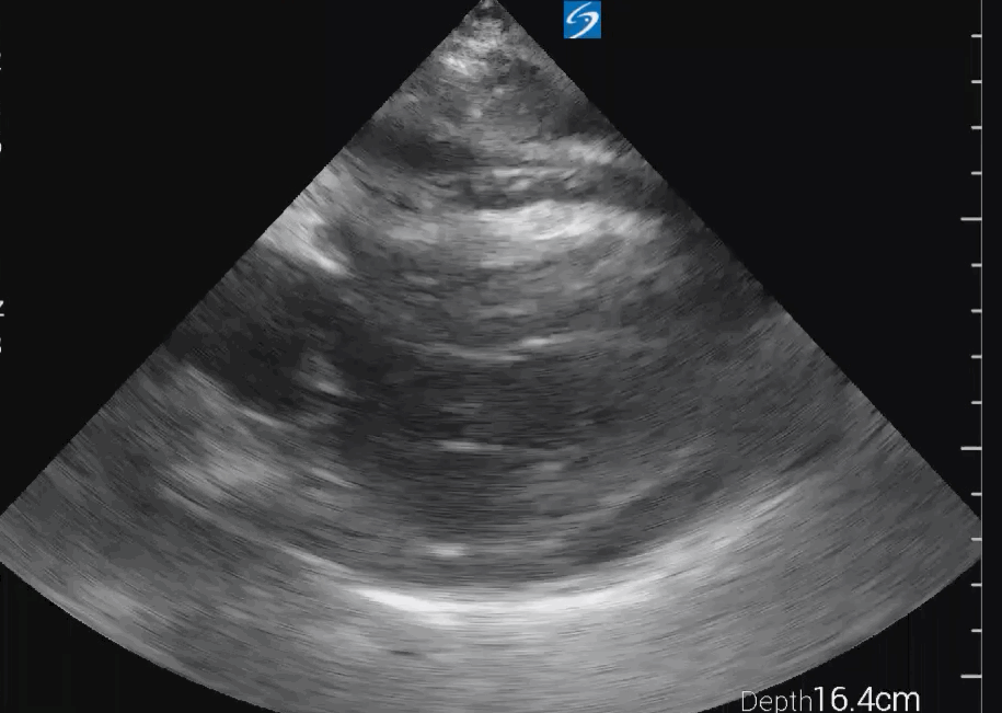 EEU case image missing